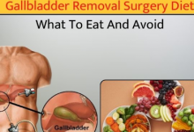 gallbladder-diet:-foods-to-eat-and-avoid-after-gallbladder-surgery