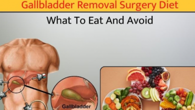 gallbladder-diet:-foods-to-eat-and-avoid-after-gallbladder-surgery